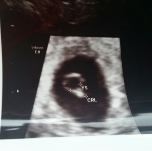 Ultrasound at 6weeks where I saw the heartbeat for the first time